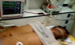 نجات بیمار قلبی از مرگ حتمی با تلاش کادر درمانی منطقه ویژه پارس